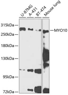 Western Blot: myosin X Antibody [NBP2-94033] - Western blot analysis of extracts of various cell lines, using myosin X antibody (NBP2-94033) at 1:1000 dilution. Secondary antibody: HRP Goat Anti-Rabbit IgG (H+L) at 1:10000 dilution. Lysates/proteins: 25ug per lane. Blocking buffer: 3% nonfat dry milk in TBST. Detection: ECL Enhanced Kit. Exposure time: 90s.